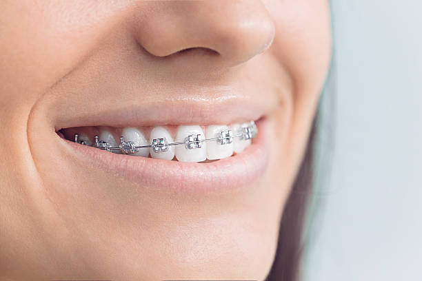 Best Dental Fillings (Composite and Amalgam)  in Cumming, GA