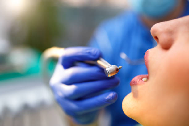 Full Mouth Reconstruction in Cumming, GA